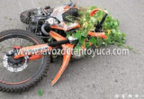 MOTOCICLISTA A PUNTO DE PERDER UNA PIERNA TRAS CHOCAR CON BARANDILLA DE SEGURIDAD