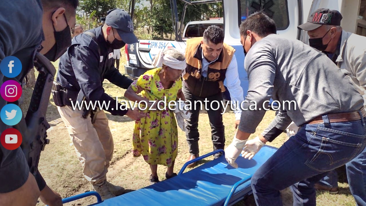 Mujer resulta lesionada tras ser atropellada en la México - Tampico ...