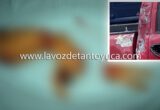 Presunto delincuente pierde un brazo tras explosión, en Huejutla