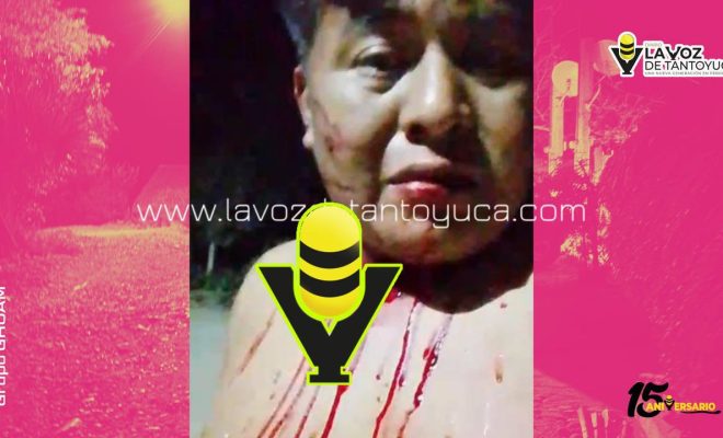 photo_4927241359228341105_y