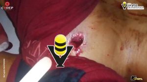 Muere hombre tras recibir disparo accidental