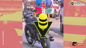 Menor resulta seriamente lesionado en choque; taxista involucrado 