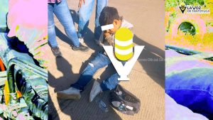 Motociclista resulta lesionado tras ser impactado por un auto compacto