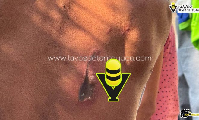 photo_5080214822862916706_y