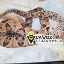Serpientes venenosas atacan a 2 jóvenes en Jaltocán y Huejutla