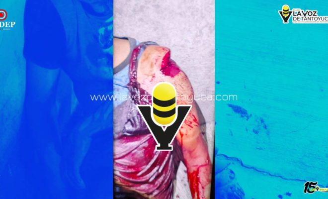 photo_5109547143097158585_y