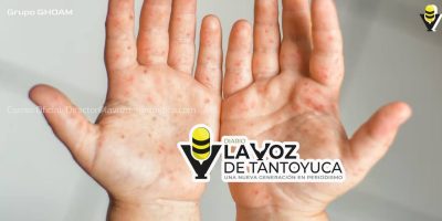 Aíslan a tres niños de kínder en Ciudad Madero por contagio del virus “mano, boca y pie”